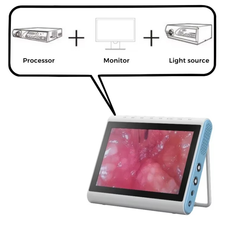 3-in-1医療内視鏡画像光源プロセッサー |   尿管鏡、 - Medical Lab Images のレビューと価格
