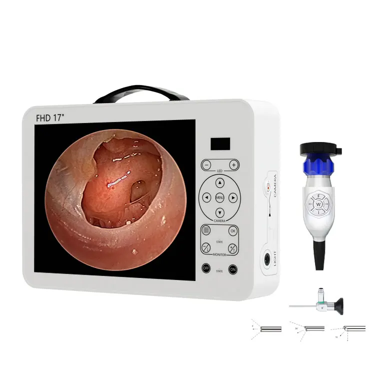 17インチHDビデオ耳鏡耳鼻咽喉科診断システムセット |   - Medical Lab Images のレビューと価格